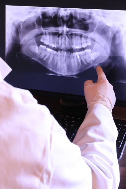 Best Emergency Treatment for Dental Infections or Abscesses in South Whitley, IN