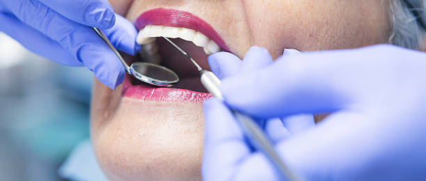 Best Pediatric Emergency Dentist in South Whitley, IN